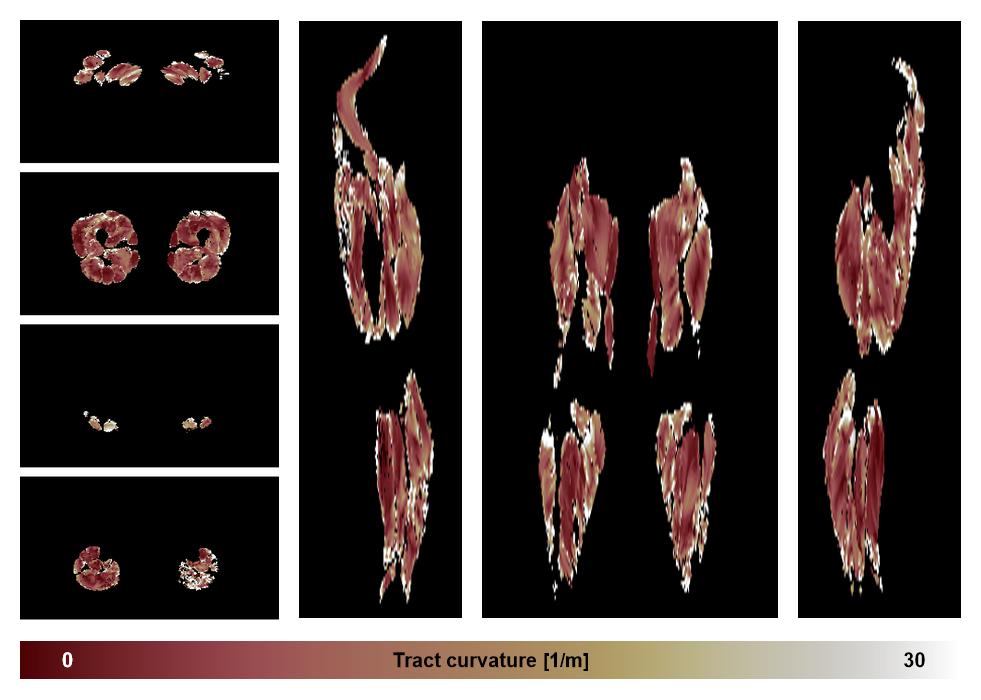 Muscle fiber tract curvature map based on whole leg DTI based fiber tractography.