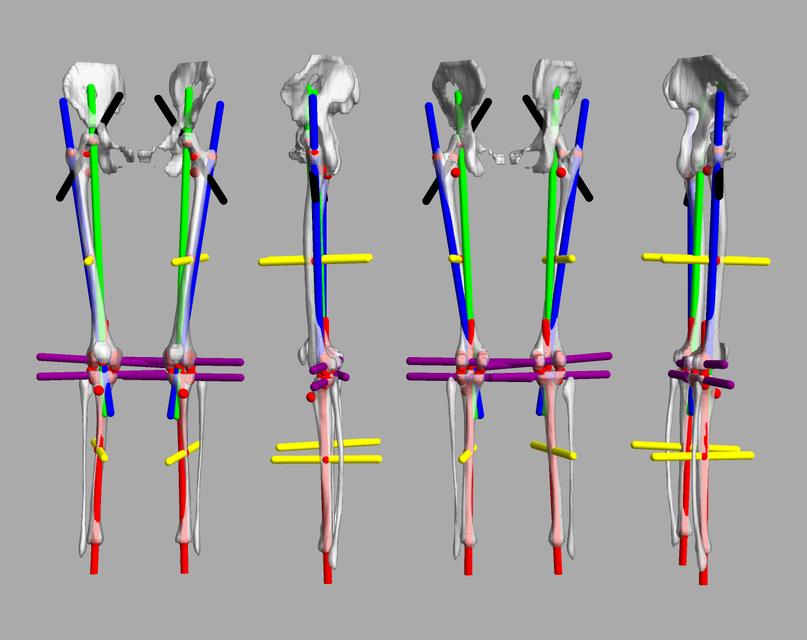 3D render of automated bone segmentation and force lines.