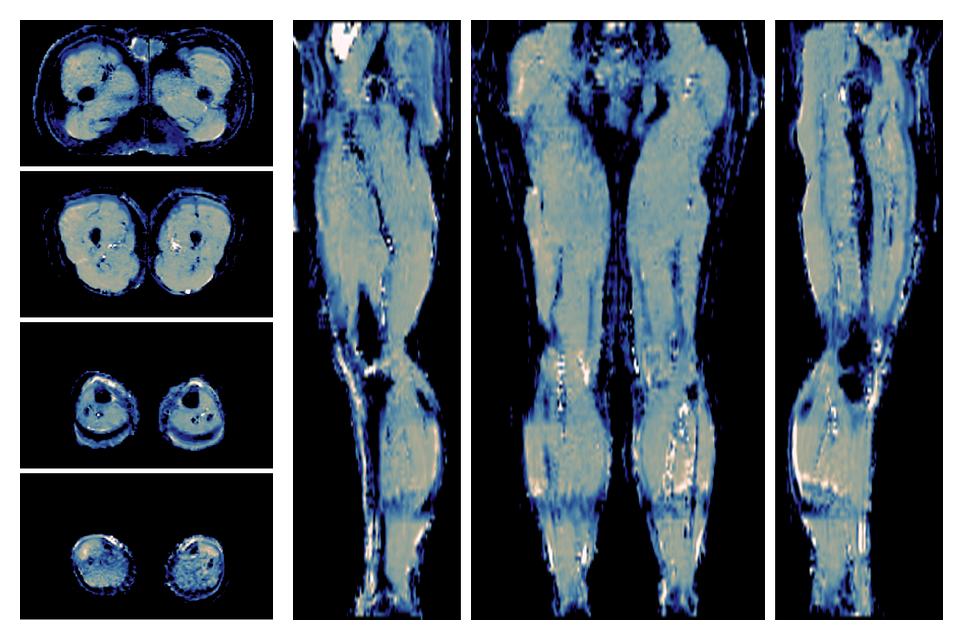 IVIM corrected whole leg muscle mean diffusivity obtained from diffusion tensor imaging.