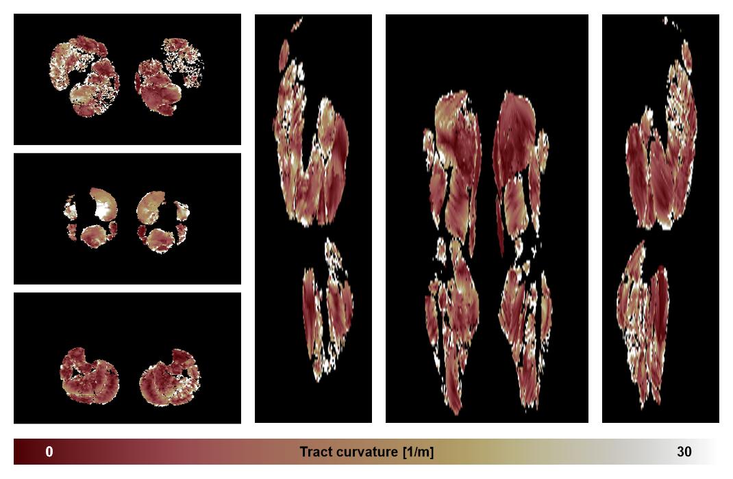 Muscle fiber tract curvature map based on whole leg DTI based fiber tractography.