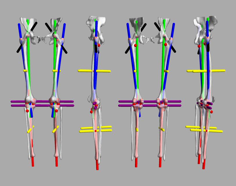 3D render of automated bone segmentation and force lines.