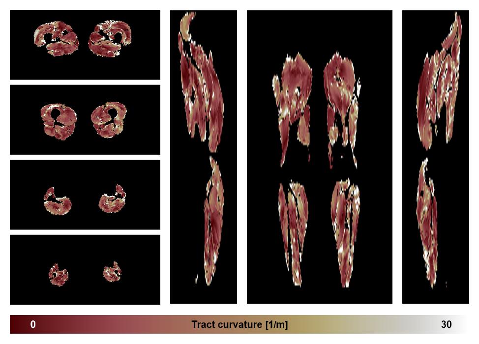 Muscle fiber tract curvature map based on whole leg DTI based fiber tractography.