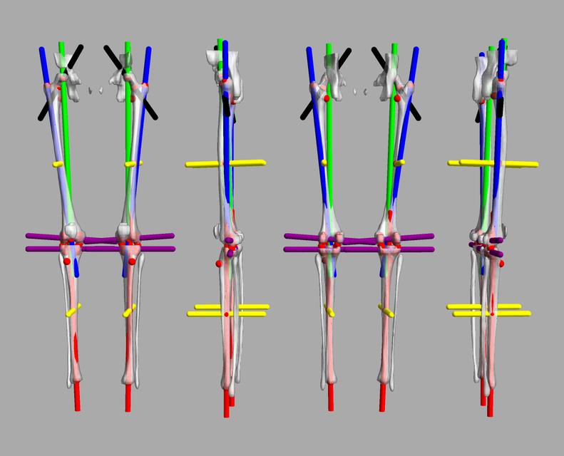 3D render of automated bone segmentation and force lines.