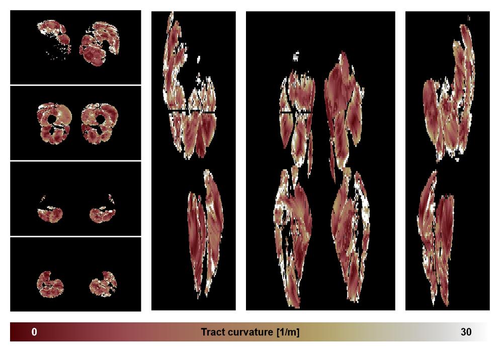 Muscle fiber tract curvature map based on whole leg DTI based fiber tractography.