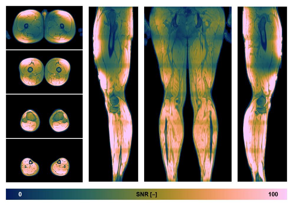 The SNR distribution of the dixon data.