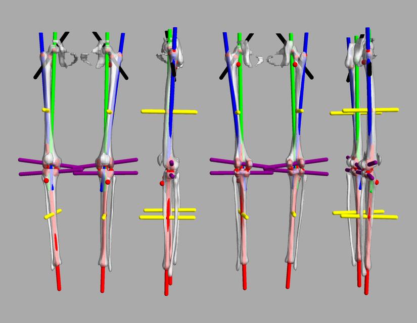 3D render of automated bone segmentation and force lines.