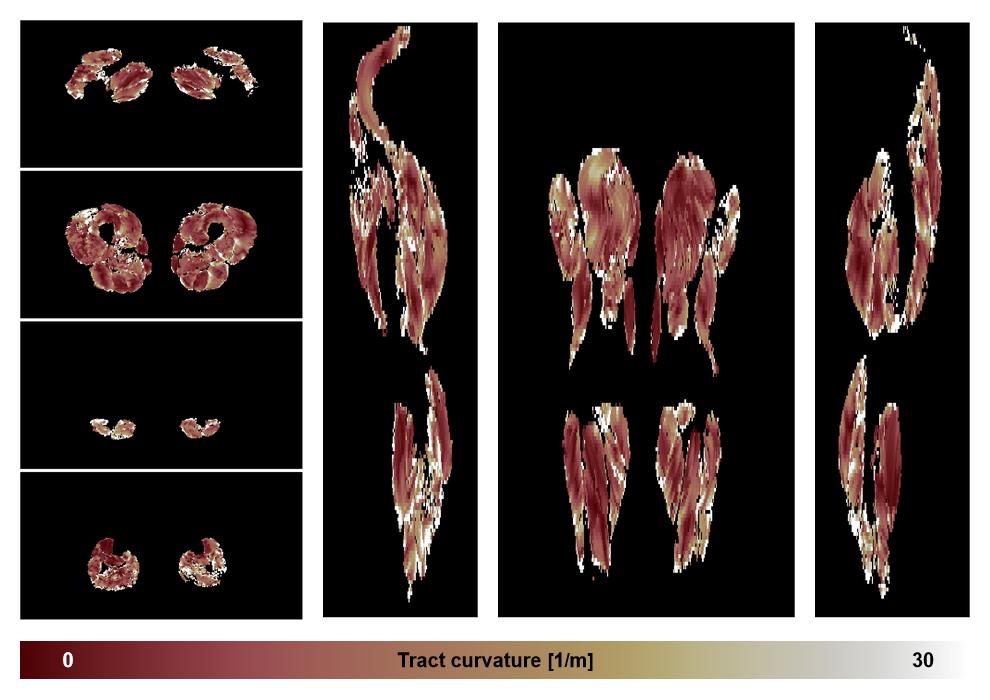 Muscle fiber tract curvature map based on whole leg DTI based fiber tractography.