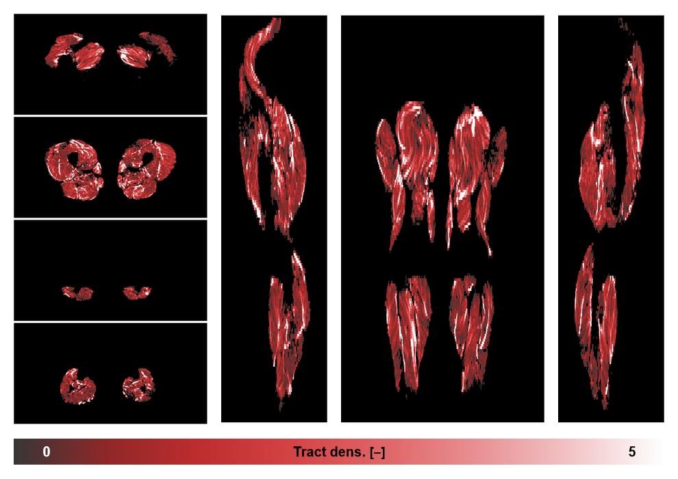 Muscle fiber tract density map based on whole leg DTI based fiber tractography.