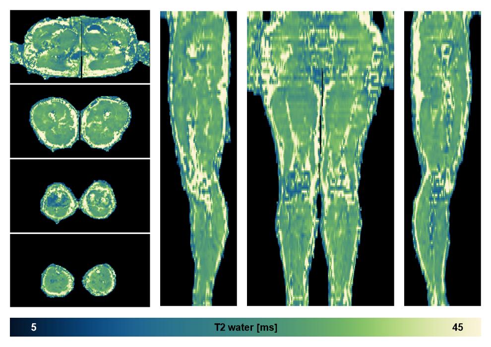 The water only T2 relaxation time of the lower extremity obtained from multi echo spin echo t2 mapping with EPG based reconstruction.