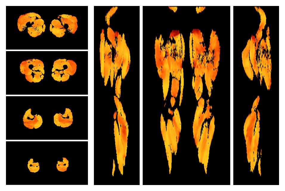 Muscle fiber tract angle map based on whole leg DTI based fiber tractography.