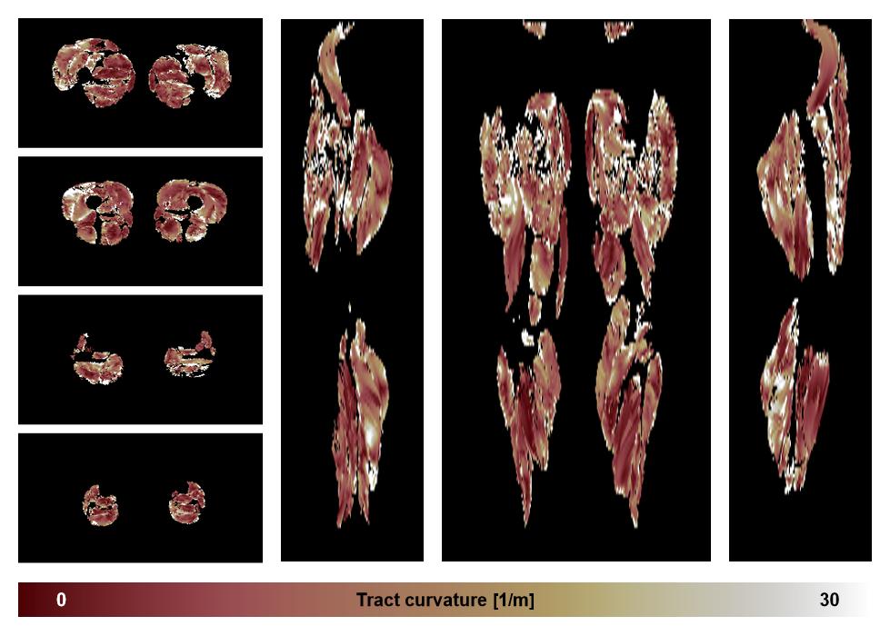 Muscle fiber tract curvature map based on whole leg DTI based fiber tractography.