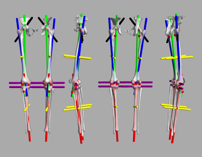 3D render of automated bone segmentation and force lines.