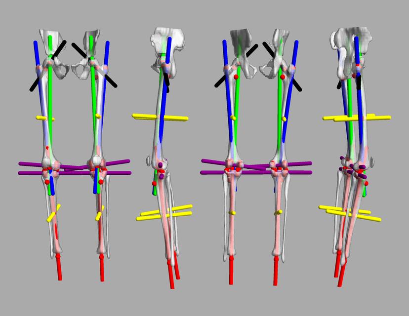 3D render of automated bone segmentation and force lines.