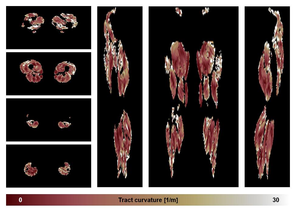 Muscle fiber tract curvature map based on whole leg DTI based fiber tractography.