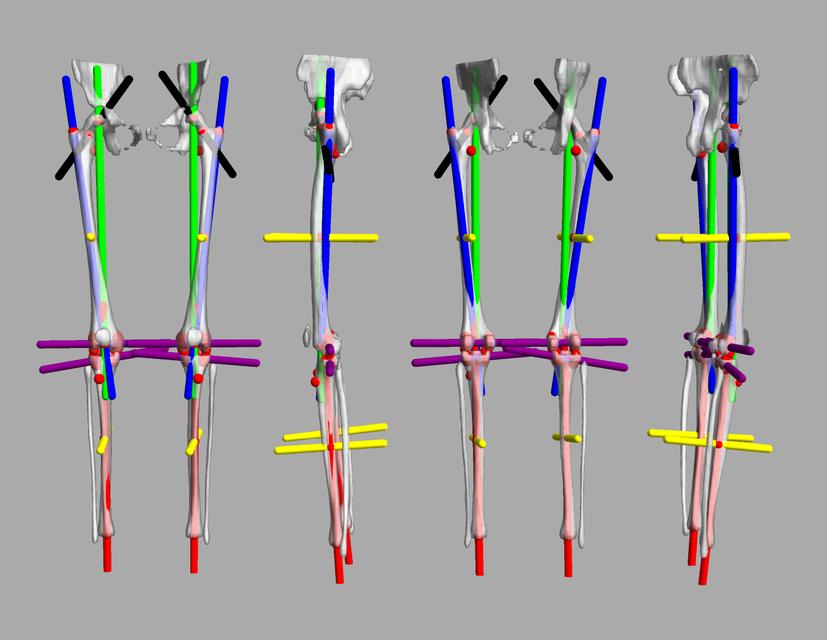 3D render of automated bone segmentation and force lines.