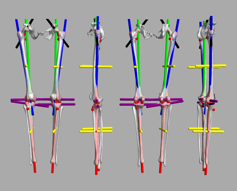 3D render of automated bone segmentation and force lines.