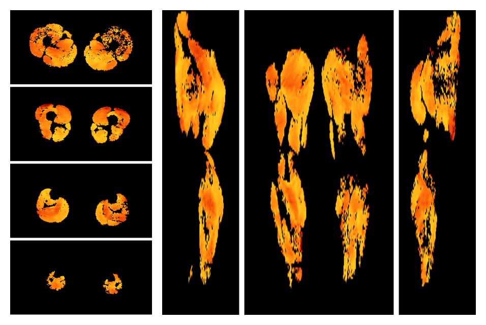 Muscle fiber tract angle map based on whole leg DTI based fiber tractography.