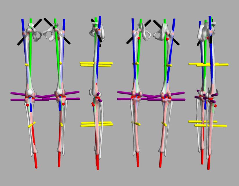 3D render of automated bone segmentation and force lines.