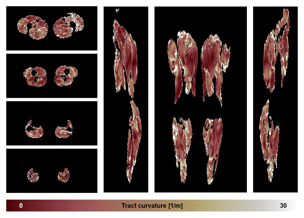 Muscle fiber tract curvature map based on whole leg DTI based fiber tractography.