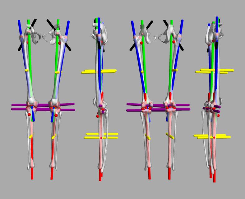 3D render of automated bone segmentation and force lines.