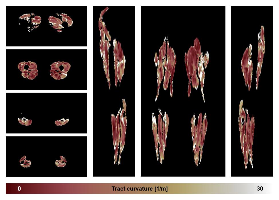 Muscle fiber tract curvature map based on whole leg DTI based fiber tractography.