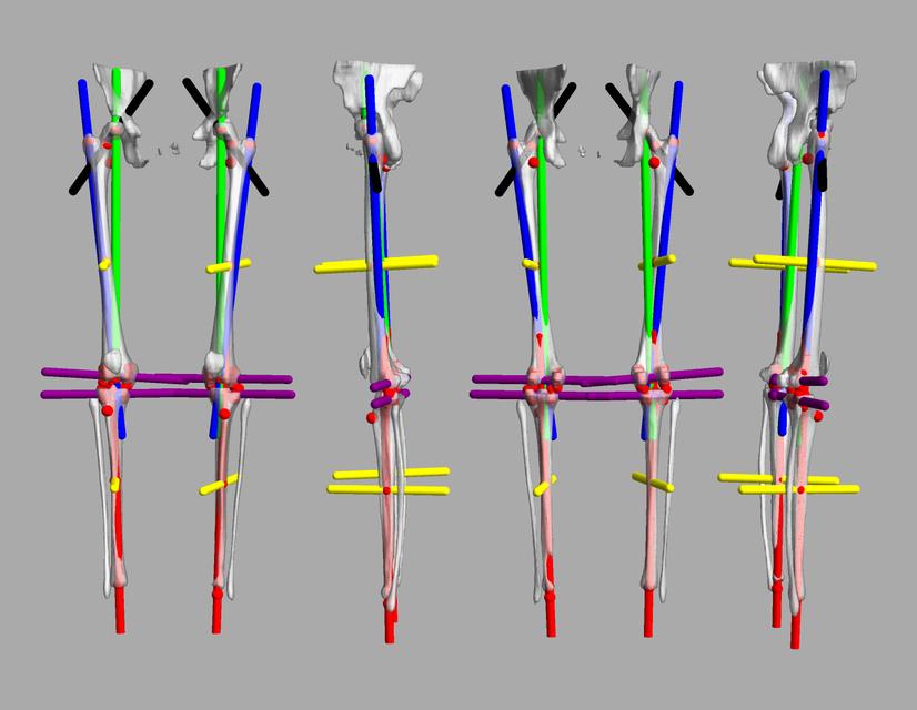 3D render of automated bone segmentation and force lines.