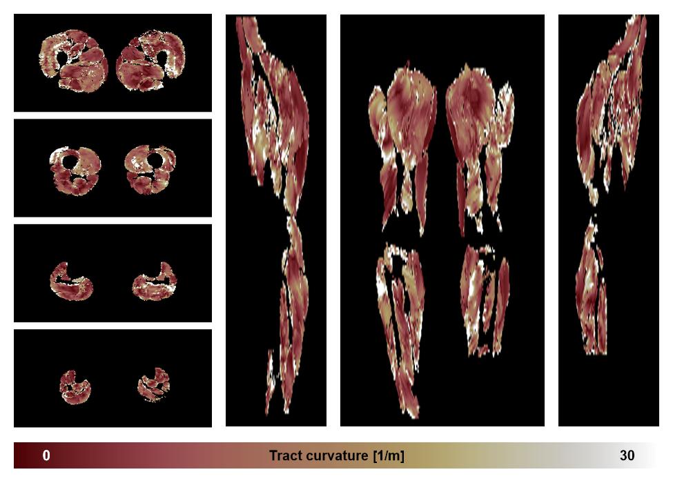 Muscle fiber tract curvature map based on whole leg DTI based fiber tractography.