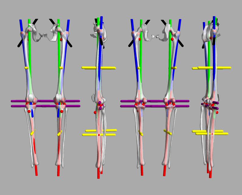 3D render of automated bone segmentation and force lines.