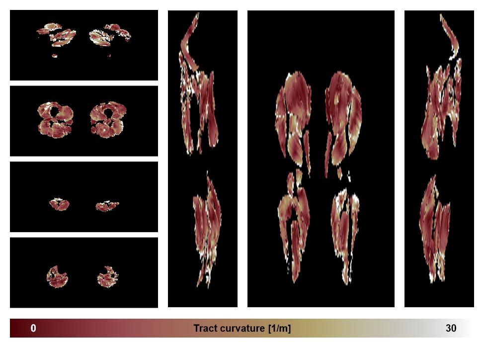 Muscle fiber tract curvature map based on whole leg DTI based fiber tractography.