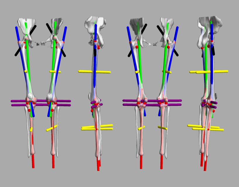 3D render of automated bone segmentation and force lines.