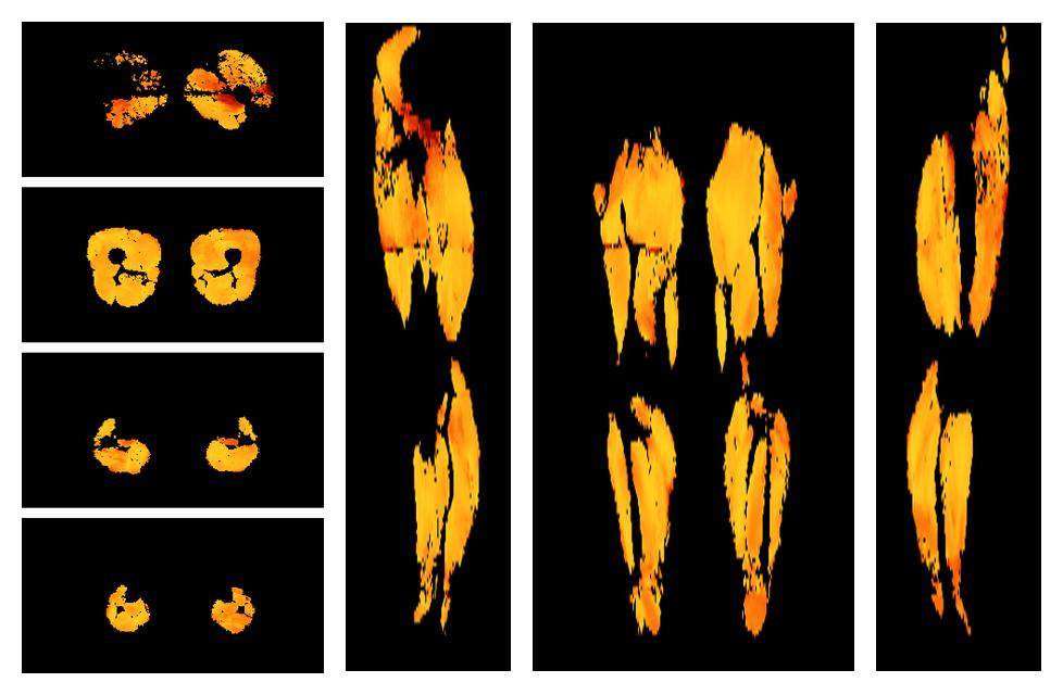 Muscle fiber tract angle map based on whole leg DTI based fiber tractography.