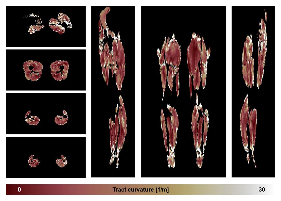 Muscle fiber tract curvature map based on whole leg DTI based fiber tractography.