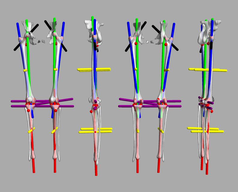 3D render of automated bone segmentation and force lines.