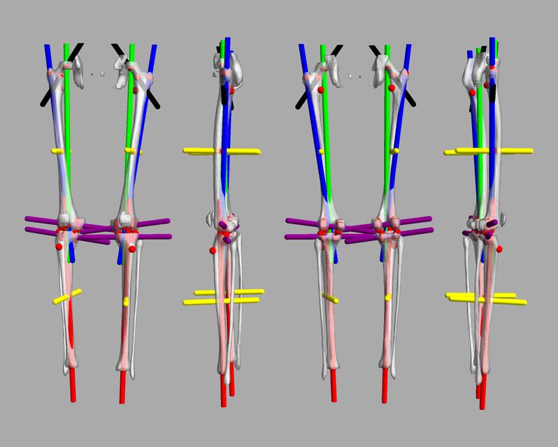 3D render of automated bone segmentation and force lines.