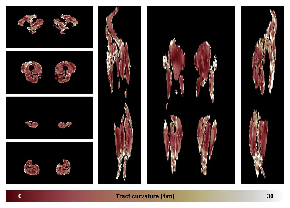 Muscle fiber tract curvature map based on whole leg DTI based fiber tractography.