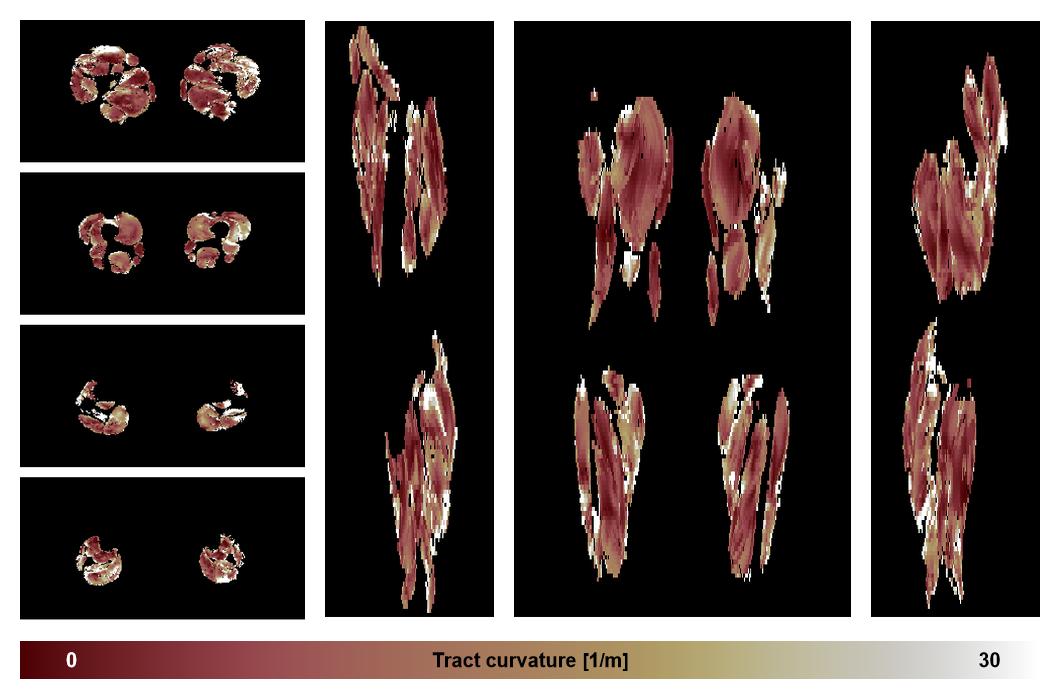 Muscle fiber tract curvature map based on whole leg DTI based fiber tractography.