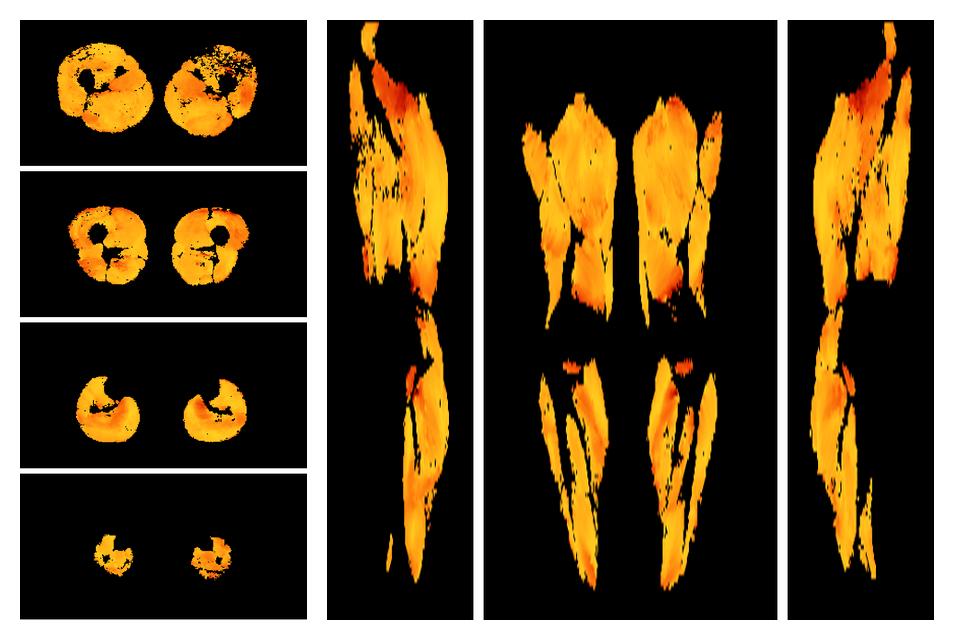 Muscle fiber tract angle map based on whole leg DTI based fiber tractography.