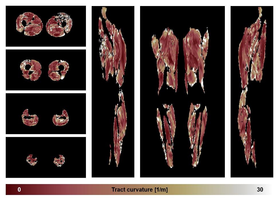 Muscle fiber tract curvature map based on whole leg DTI based fiber tractography.