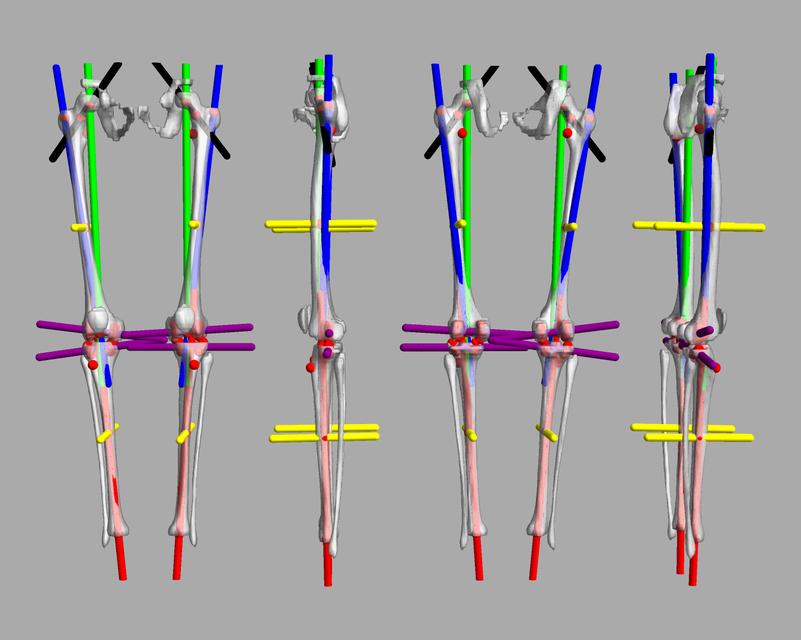 3D render of automated bone segmentation and force lines.