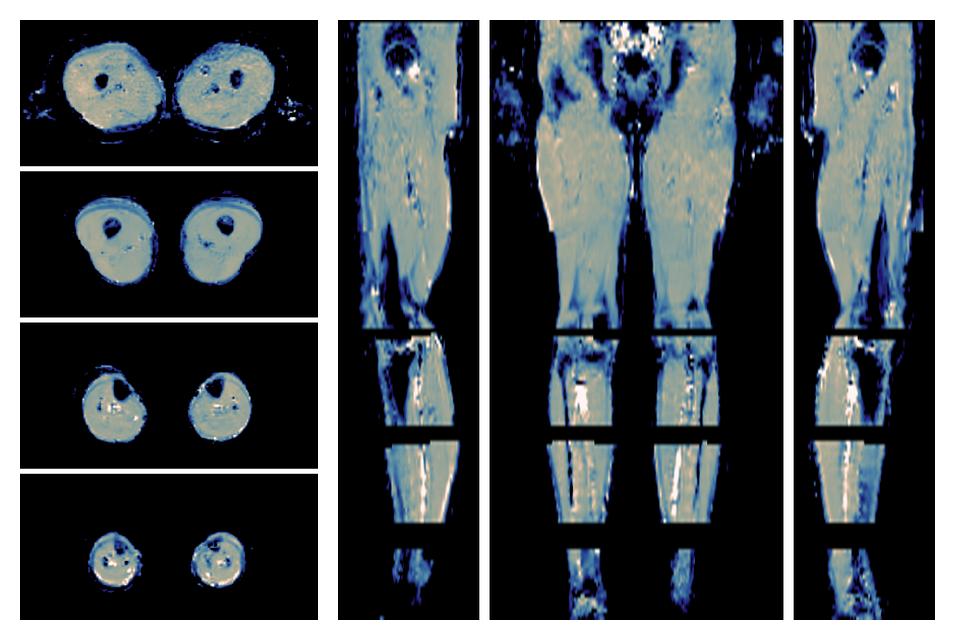 IVIM corrected whole leg muscle mean diffusivity obtained from diffusion tensor imaging.