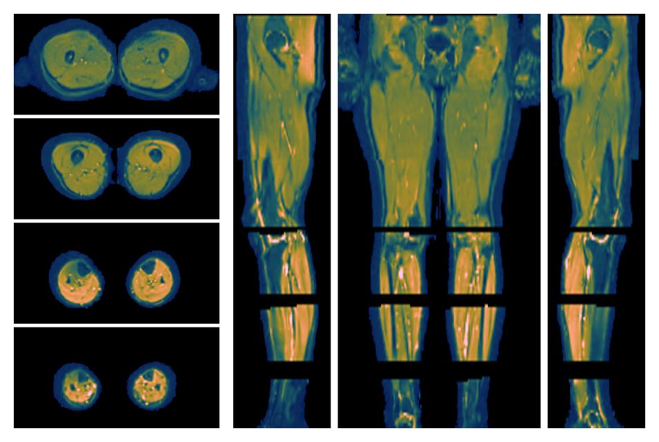 SNR distribution of the unweighted diffusion data.