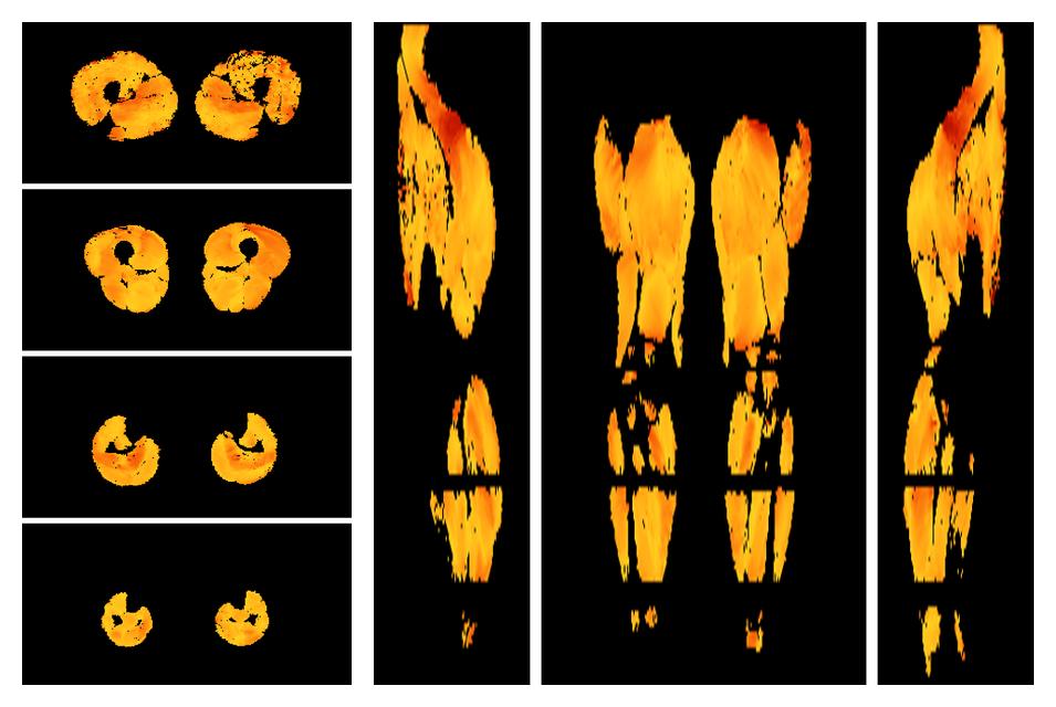 Muscle fiber tract angle map based on whole leg DTI based fiber tractography.