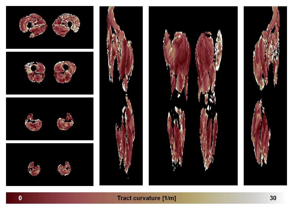 Muscle fiber tract curvature map based on whole leg DTI based fiber tractography.