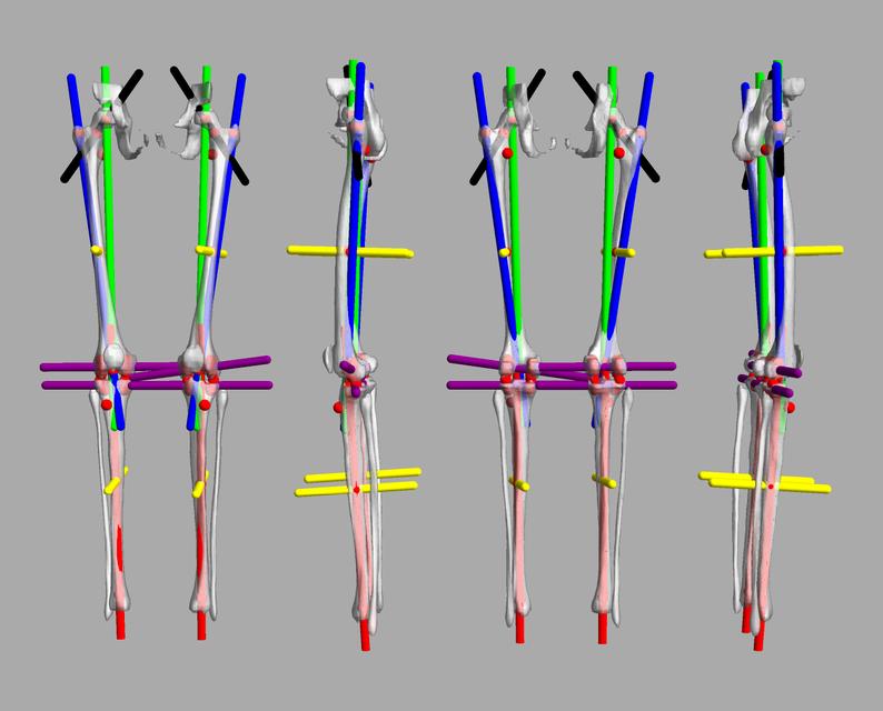 3D render of automated bone segmentation and force lines.