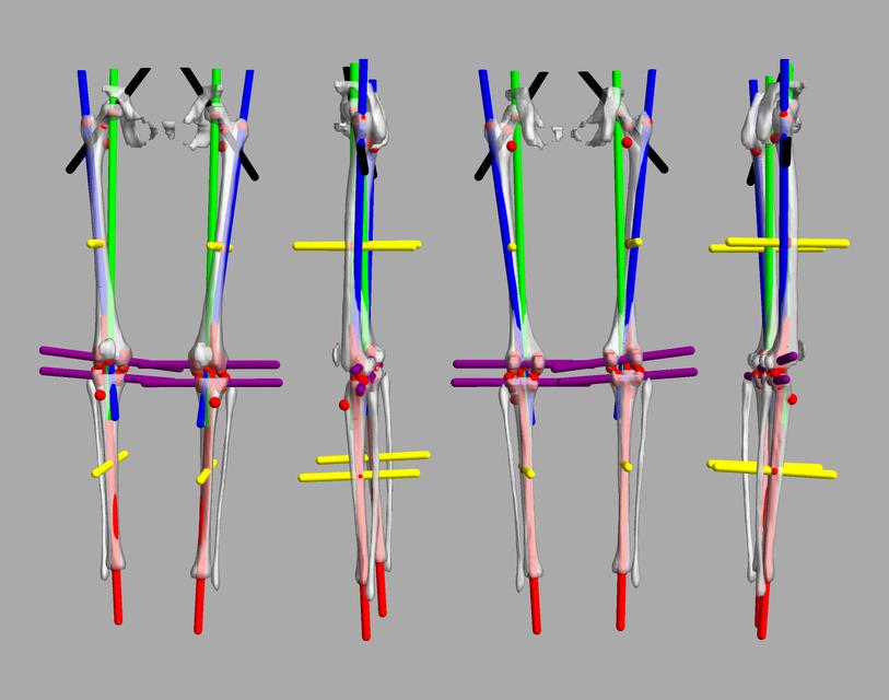 3D render of automated bone segmentation and force lines.