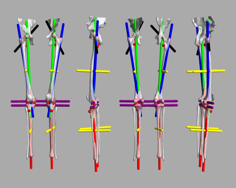 3D render of automated bone segmentation and force lines.