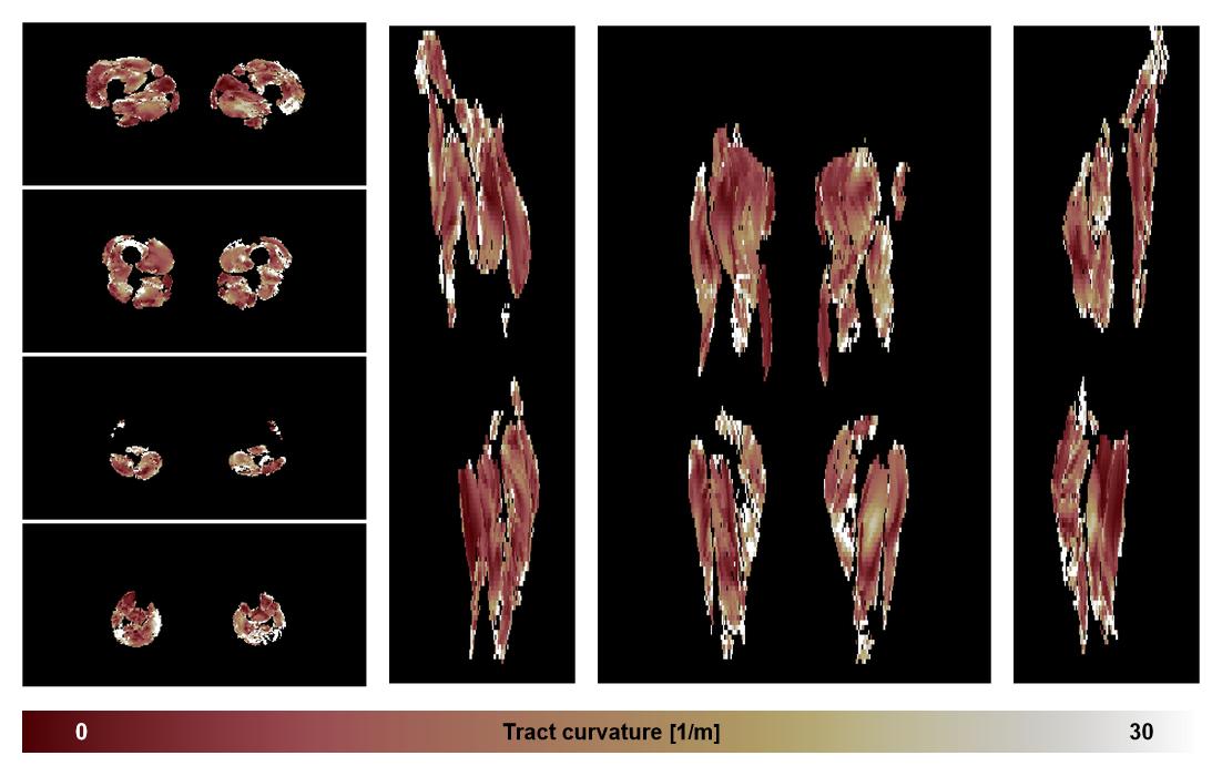 Muscle fiber tract curvature map based on whole leg DTI based fiber tractography.