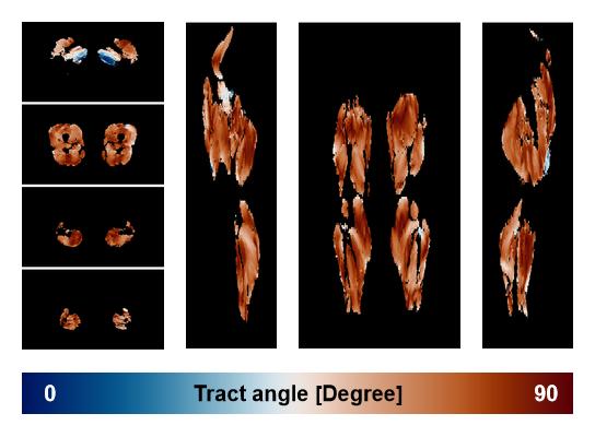 Muscle fiber tract angle map based on whole leg DTI based fiber tractography.