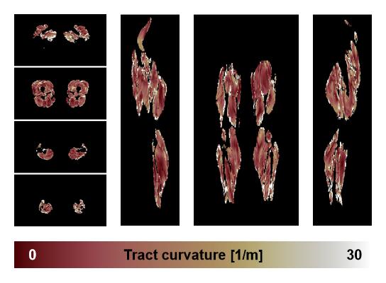 Muscle fiber tract curvature map based on whole leg DTI based fiber tractography.