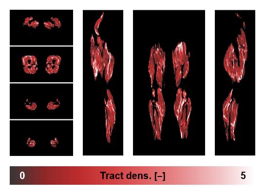 Muscle fiber tract density map based on whole leg DTI based fiber tractography.